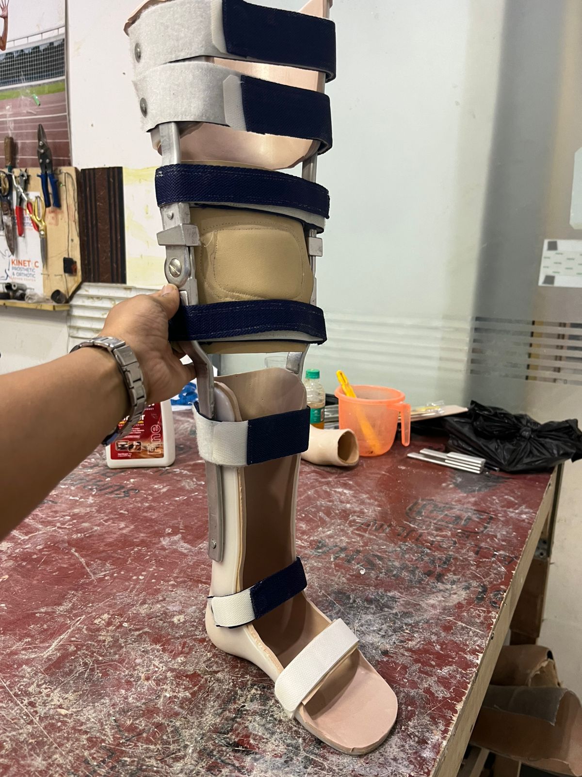 KAFO — orthotic work by Divine Artificial Limb Solutions
