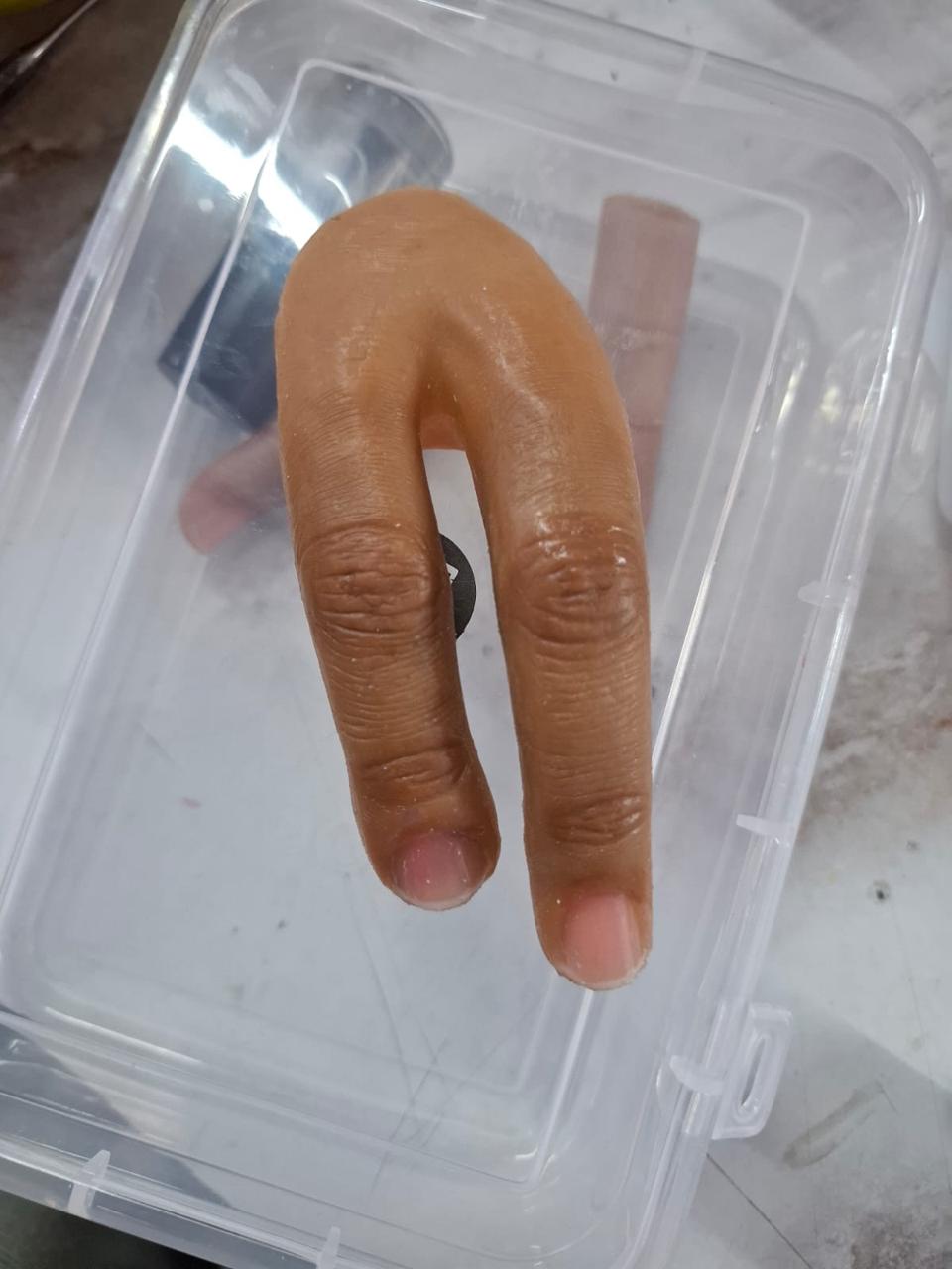 Silicone Partial Hand — silicone restoration work by Divine Artificial Limb Solutions