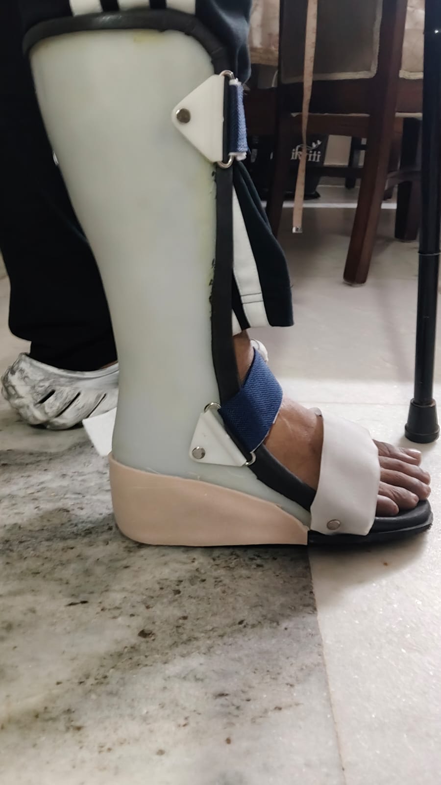 Ankle Foot Orthosis (AFO) — orthotic work by Divine Artificial Limb Solutions