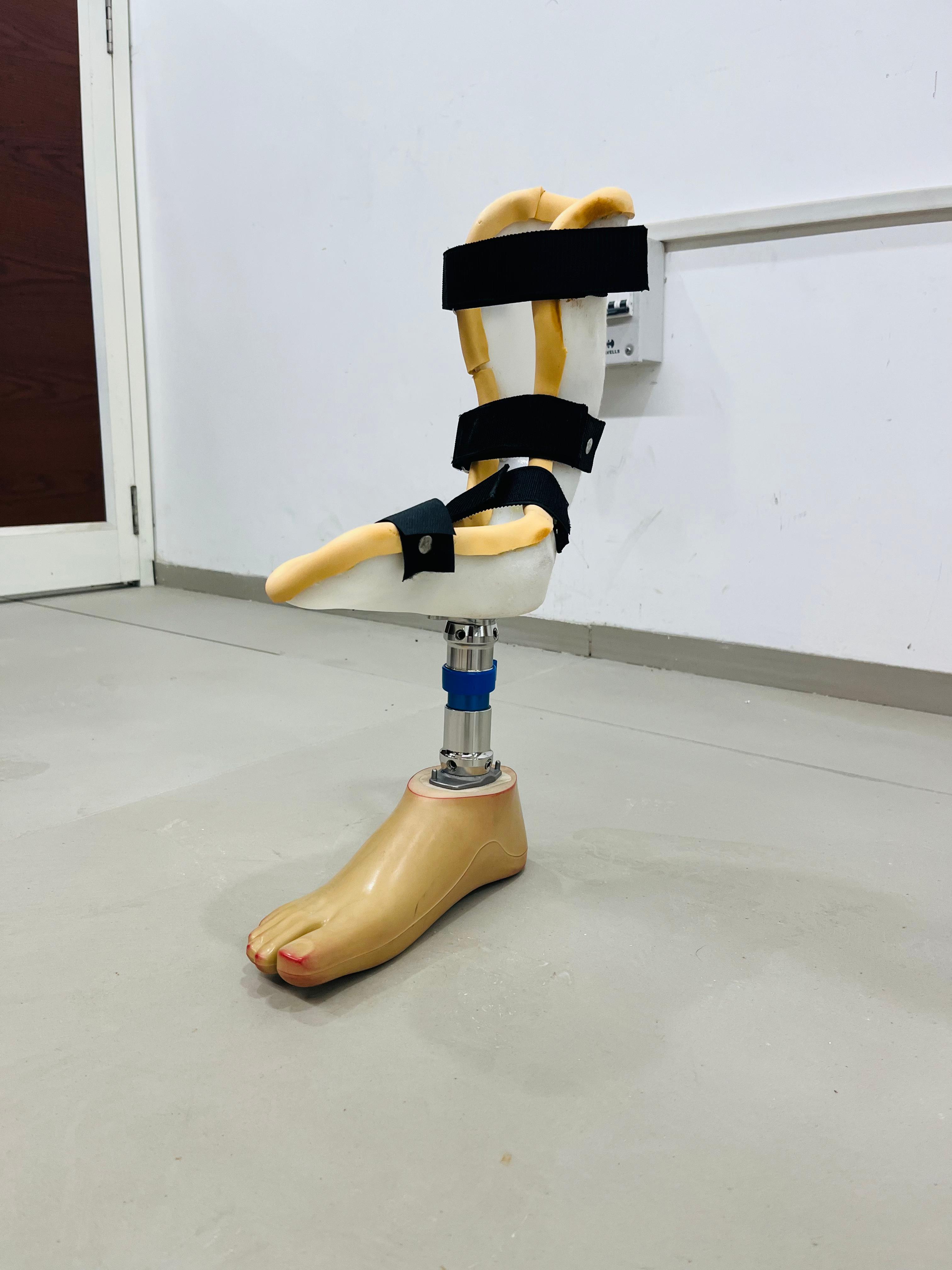 Partial Foot Prosthesis — prosthetic work by Divine Artificial Limb Solutions
