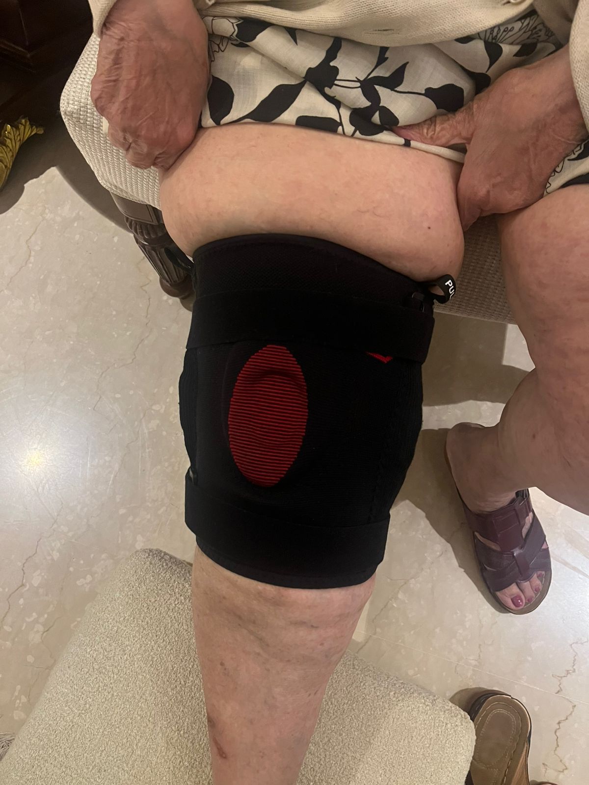 ROM Knee Brace — orthotic work by Divine Artificial Limb Solutions