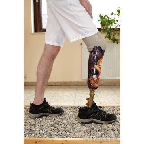 Below Knee Prosthesis — prosthetic work by Divine Artificial Limb Solutions