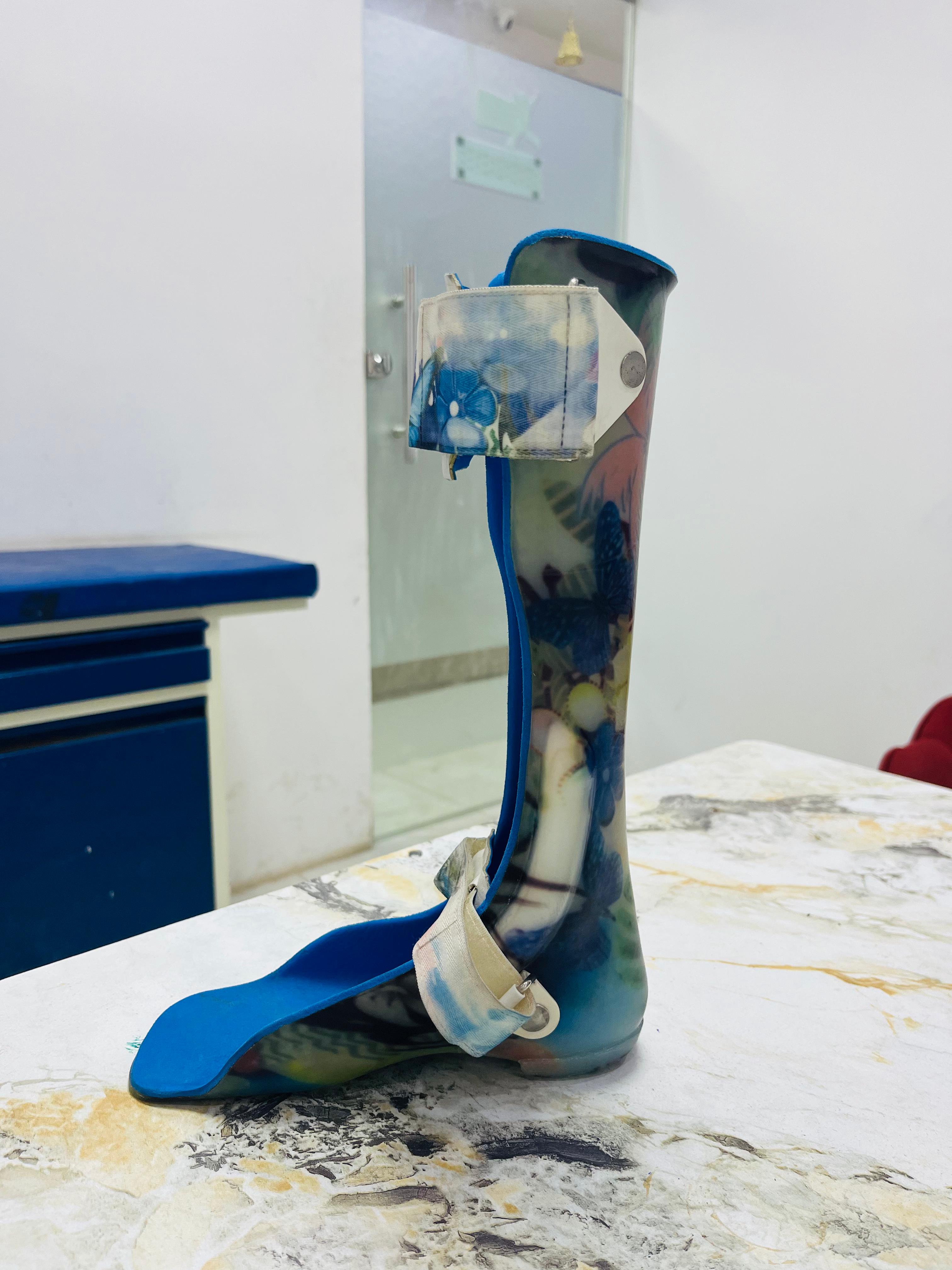 Solid AFO — orthotic work by Divine Artificial Limb Solutions