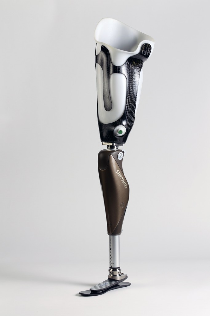 Above Knee Prosthesis — prosthetic work by Divine Artificial Limb Solutions
