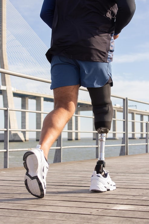 Below Knee Prosthesis — prosthetic work by Divine Artificial Limb Solutions