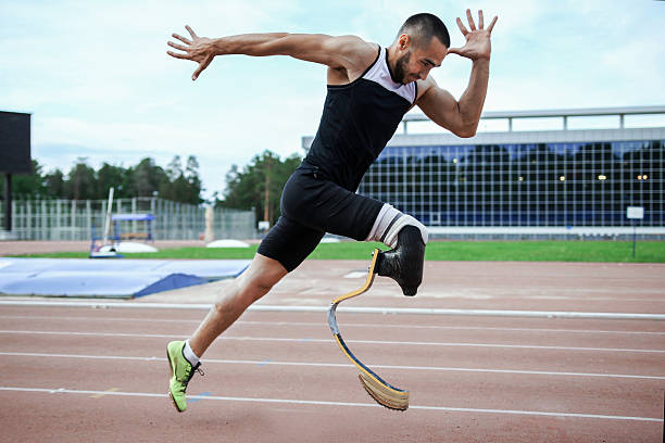 Below Knee Prosthesis — prosthetic work by Divine Artificial Limb Solutions