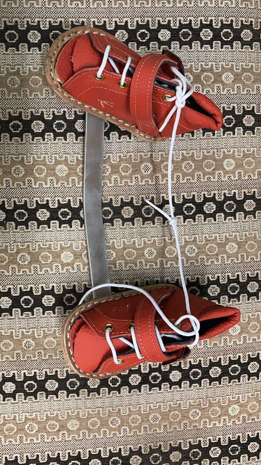 Denis-Browne Splint — orthotic work by Divine Artificial Limb Solutions