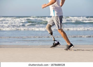 Below Knee Prosthesis — prosthetic work by Divine Artificial Limb Solutions