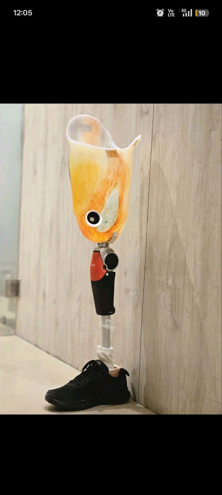 Below Knee Prosthesis — prosthetic work by Divine Artificial Limb Solutions