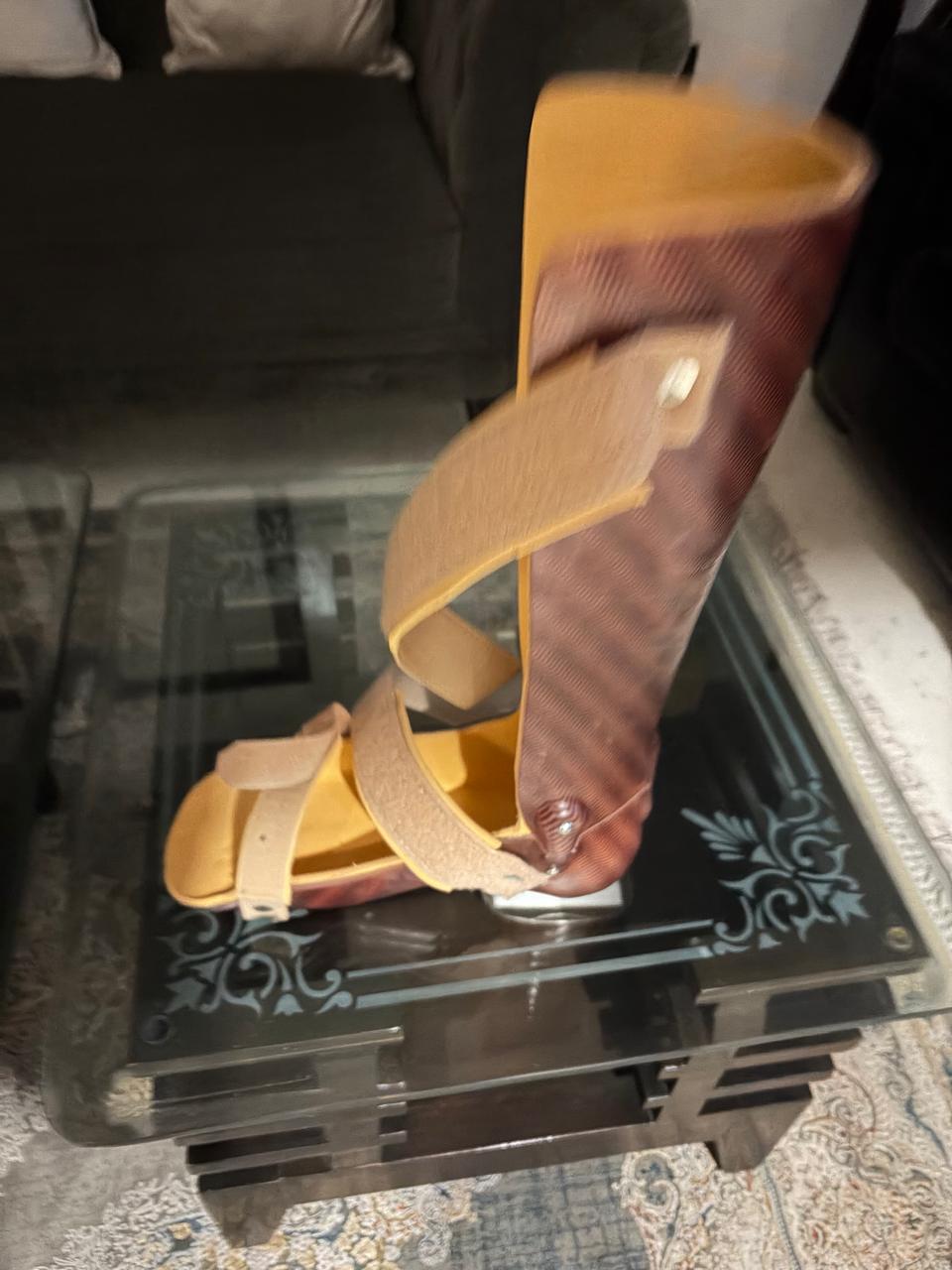 Ankle Foot Orthosis (AFO) — orthotic work by Divine Artificial Limb Solutions