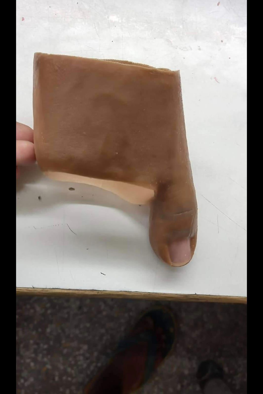 Silicone Toe Prosthesis — silicone restoration work by Divine Artificial Limb Solutions
