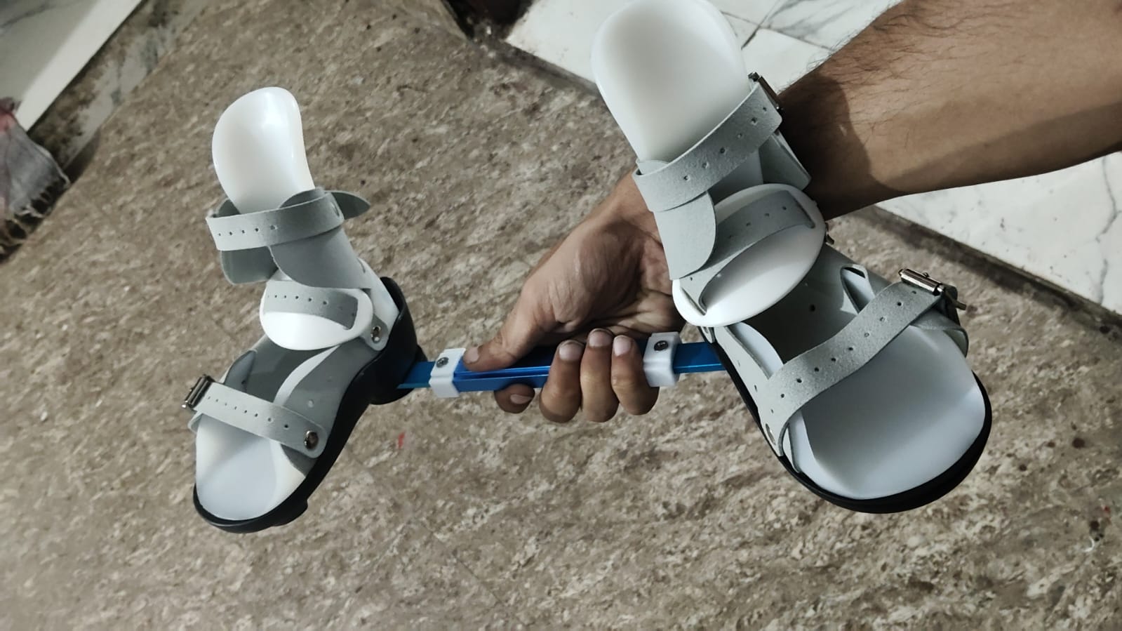 Denis-Browne Splint — orthotic work by Divine Artificial Limb Solutions