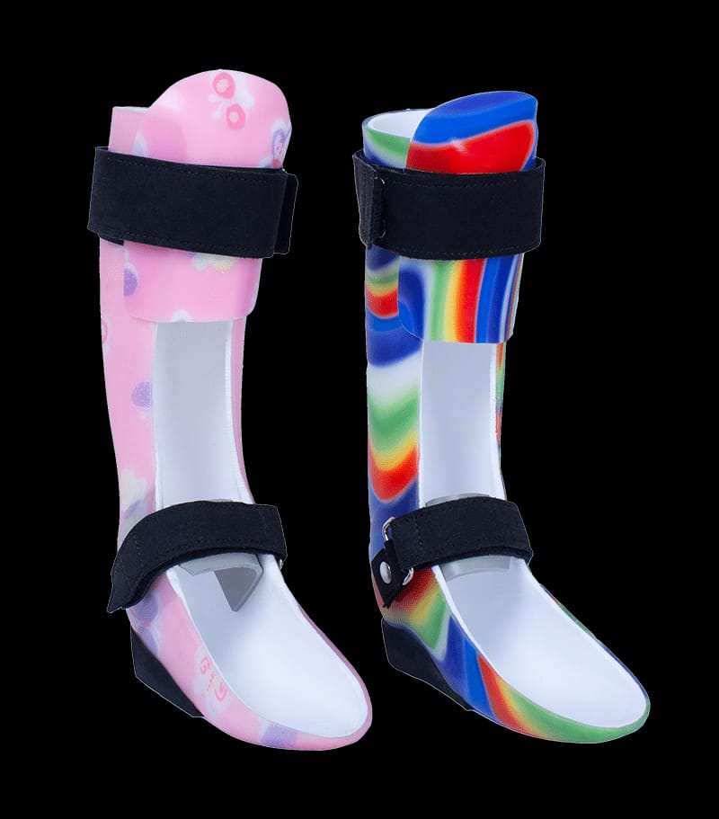 Ankle Foot Orthosis (AFO) — orthotic work by Divine Artificial Limb Solutions
