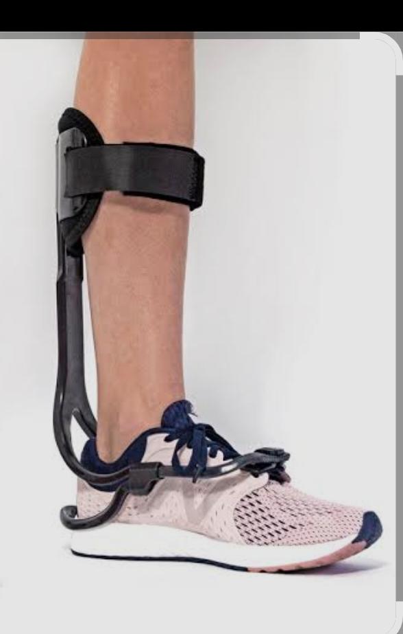 Foot Drop Splint — orthotic work by Divine Artificial Limb Solutions