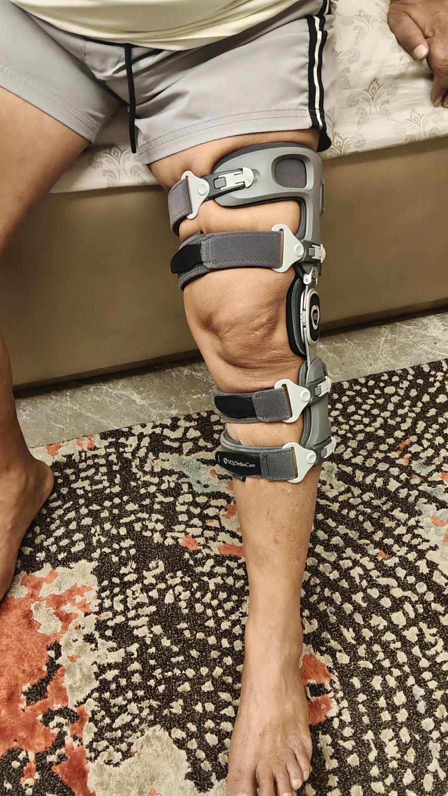 ROM Knee Brace — orthotic work by Divine Artificial Limb Solutions