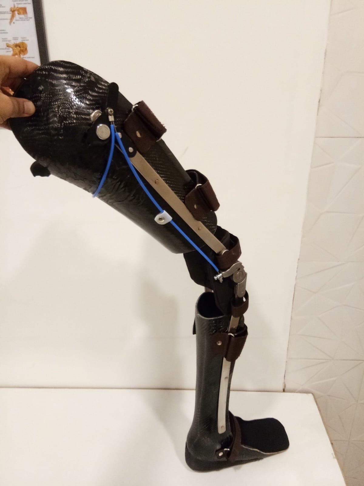 Carbon Fiber KAFO — orthotic work by Divine Artificial Limb Solutions