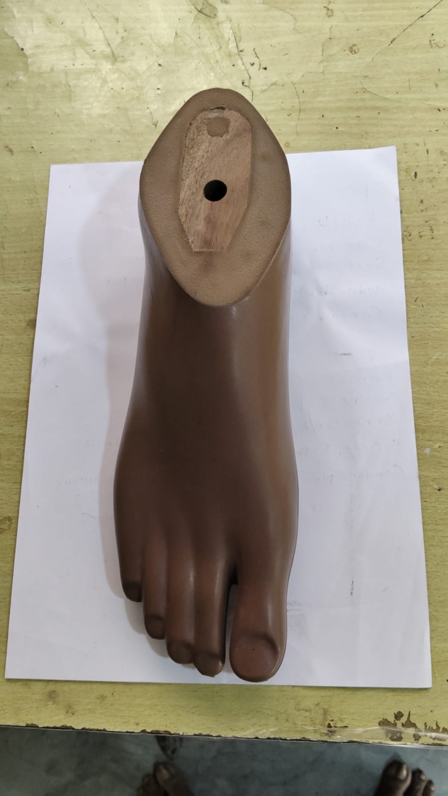 SACH Foot — prosthetic work by Divine Artificial Limb Solutions