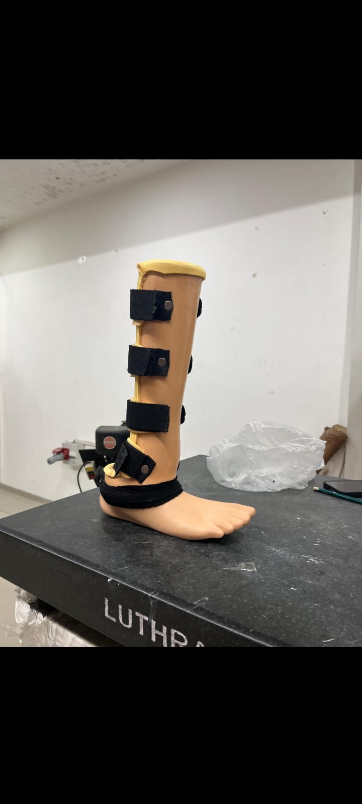 Below Knee Prosthesis — prosthetic work by Divine Artificial Limb Solutions