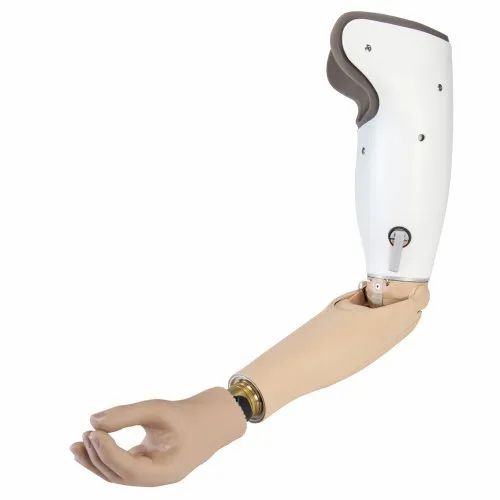Myoelectric Hand — prosthetic work by Divine Artificial Limb Solutions