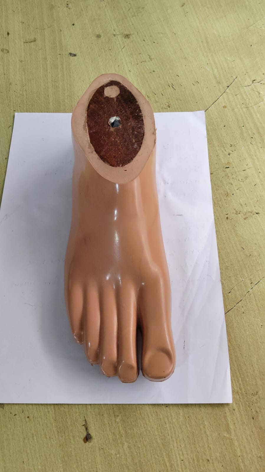 Partial Foot Prosthesis — prosthetic work by Divine Artificial Limb Solutions