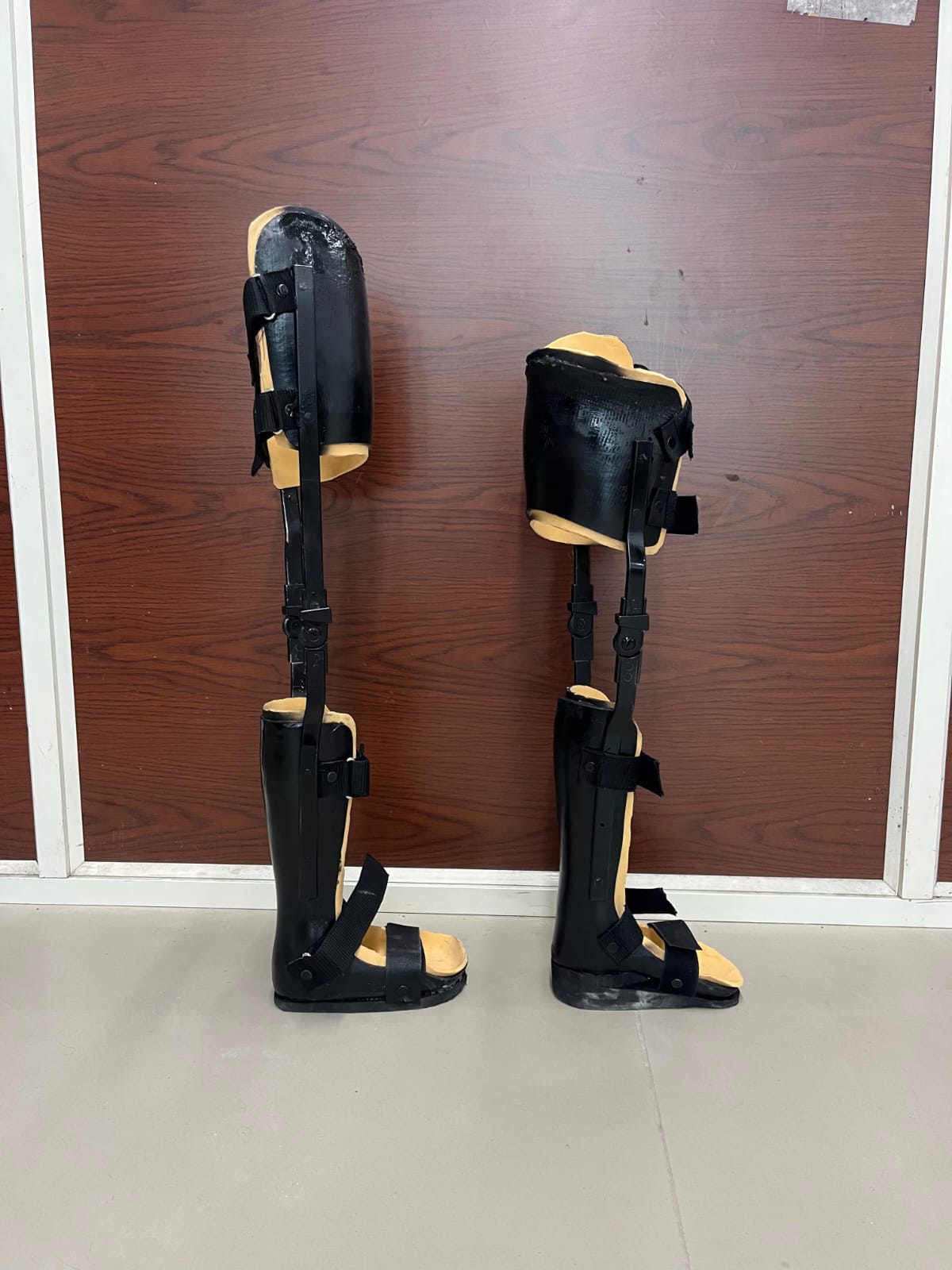 KAFO — orthotic work by Divine Artificial Limb Solutions