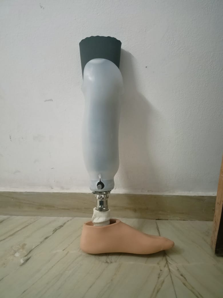 Below Knee Prosthesis — prosthetic work by Divine Artificial Limb Solutions