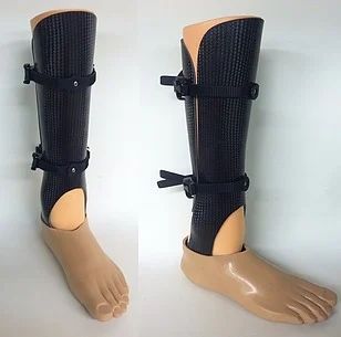 Ankle Foot Orthosis (AFO) — orthotic work by Divine Artificial Limb Solutions